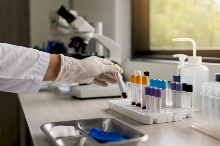 Gloved hand holding blood sample tube