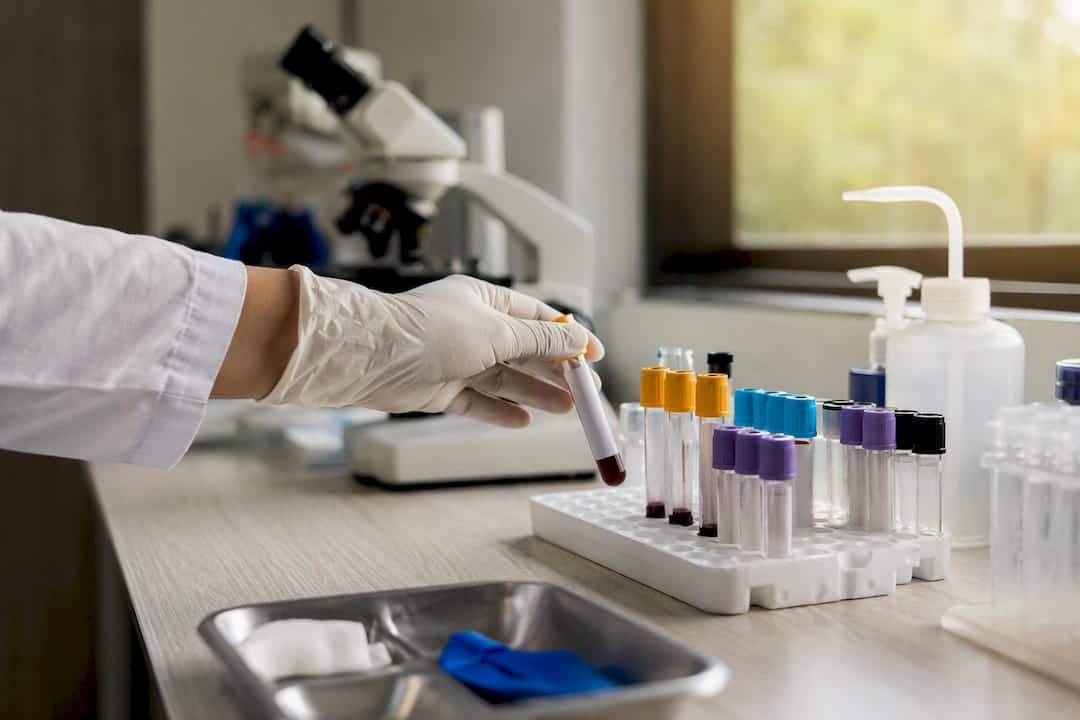 Gloved hand holding blood sample tube